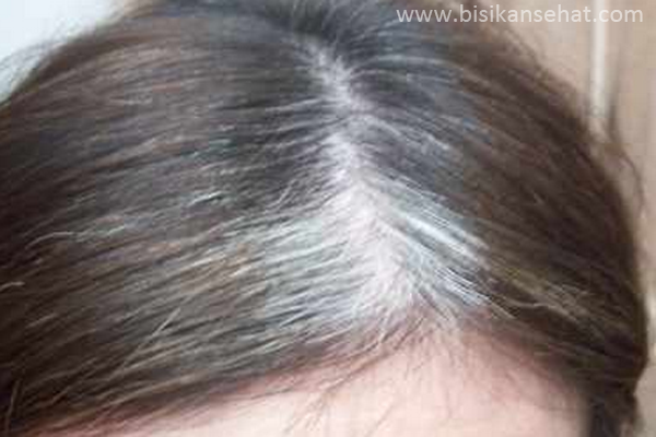 Hasil gambar untuk gambar rambut hitam dan rambut putih
