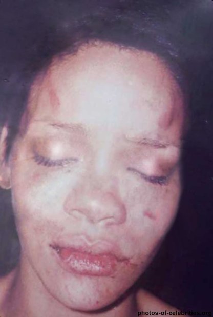 rihanna_pictures_beat_up_face_page_2_rihanna_pictures_beat_up_face.jpg
