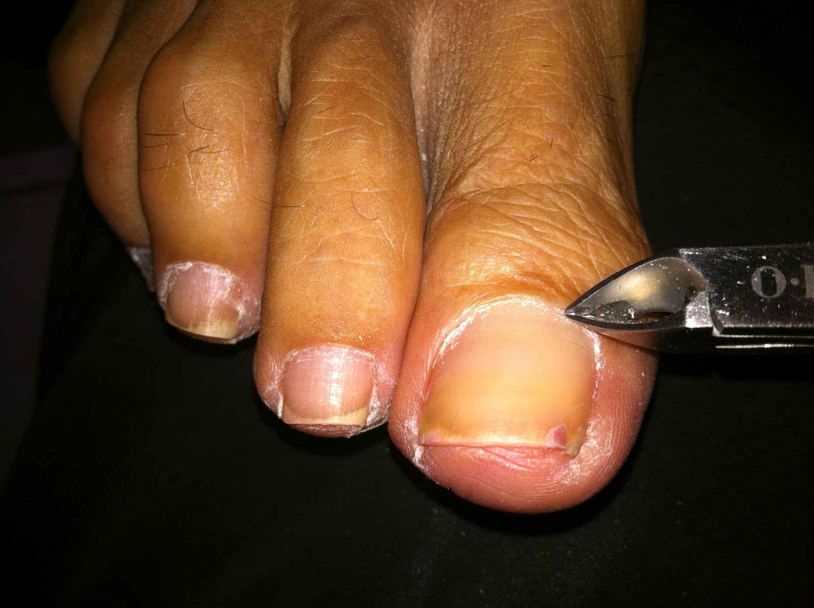 Steel Magnolias Salon Blog Perfect Toes