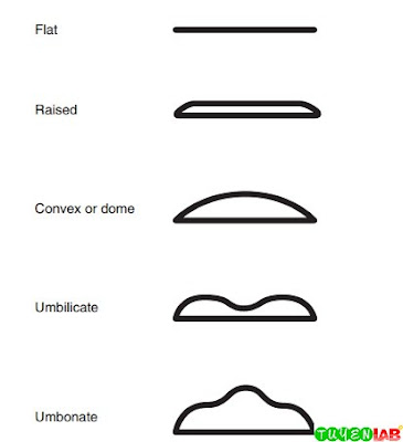 Illustration of elevations to describe colonial morphology. Illustration of elevations to describe colonial morphology.