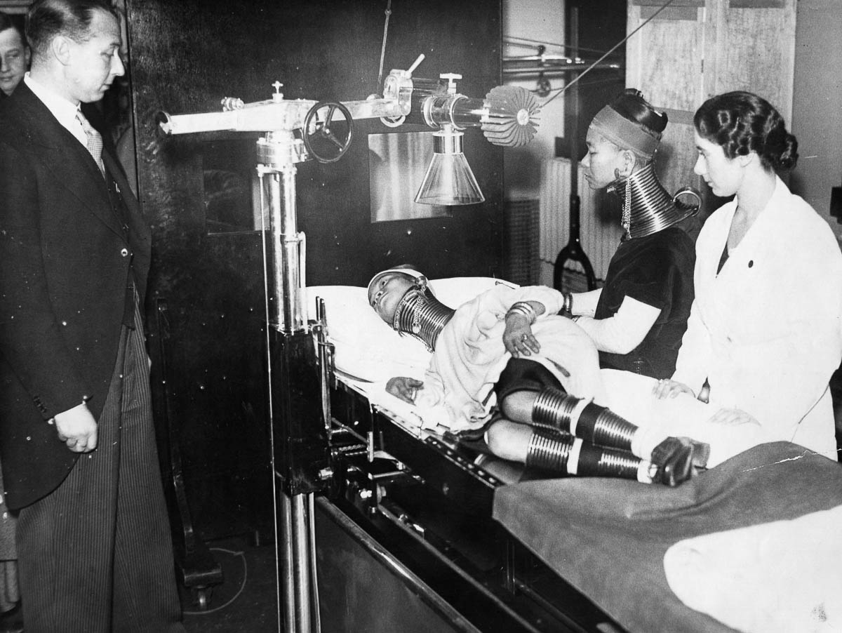 Doctors examining a Padaung woman.