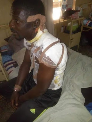 1 Photos: Angry wife pour boiling water on husband in Plateau State for marrying second wife