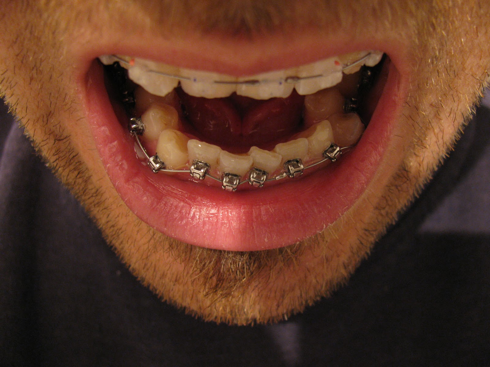 The Great Brace Race Train Tracks First Day