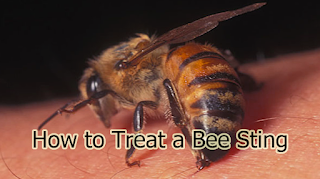How to Treat a Bee Sting