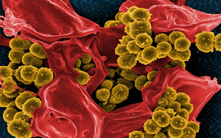 Infecciones Bacterianas Infecciones Bacterianas