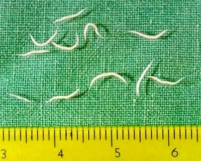 Pinworms gyermekekben, hogyan kell kezelni - lexhcaulfield.hu, Pinworm rajz
