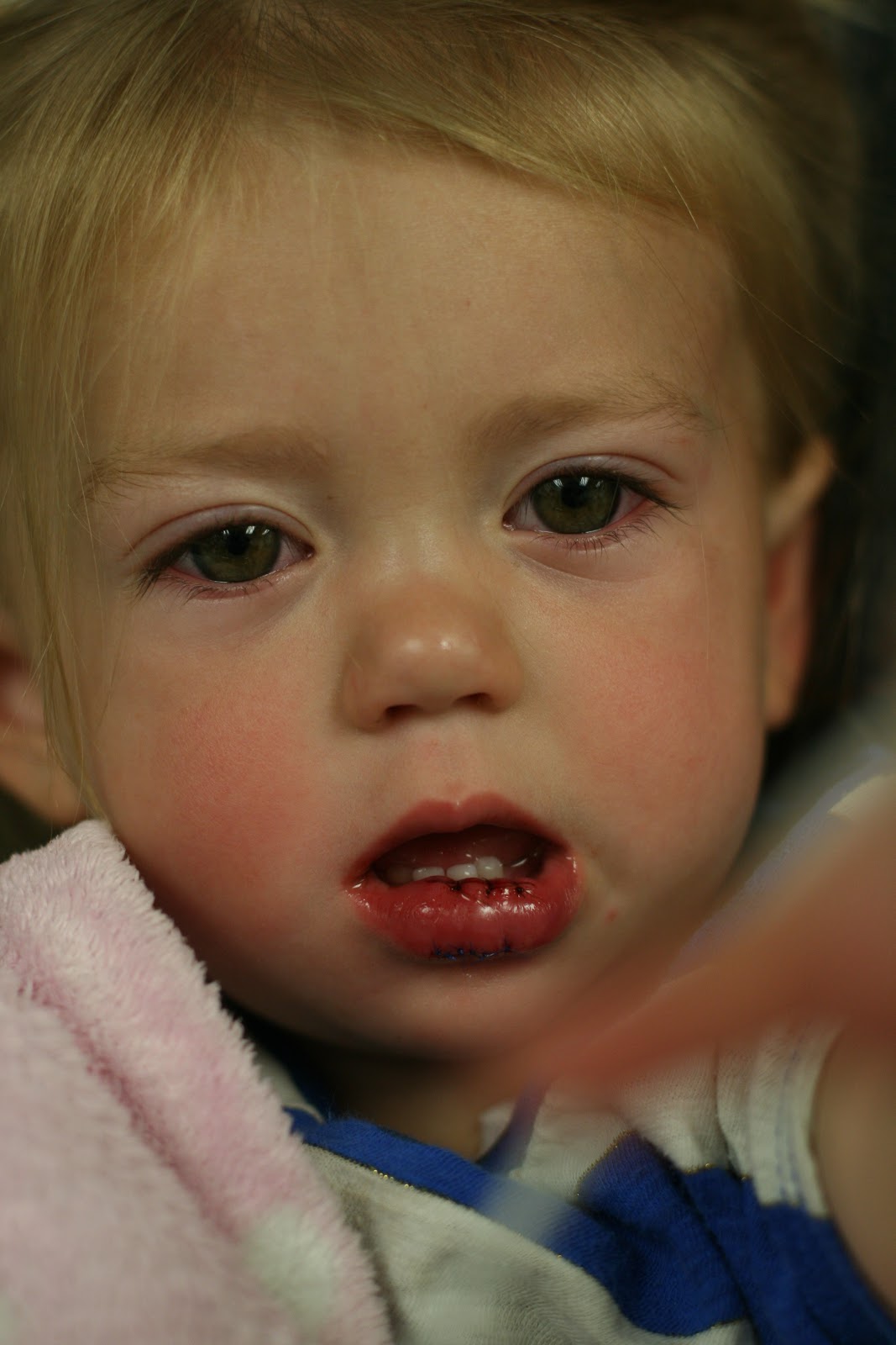 The Joneses 9 stitches