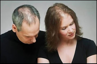 Hair Loss In Men And Treatment For Hair Loss In Women Hair Loss In Men And Treatment For Hair Loss In Women