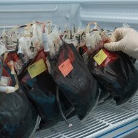 Donor Darah Bisa Bikin Langsing [ www.BlogApaAja.com ]