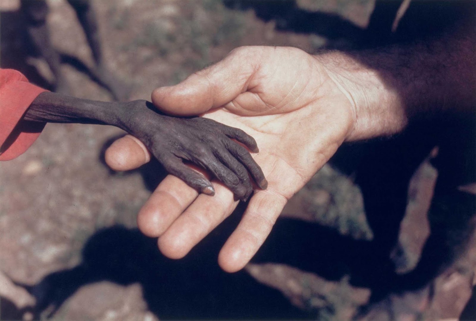 The starving boy in Uganda, 1980.