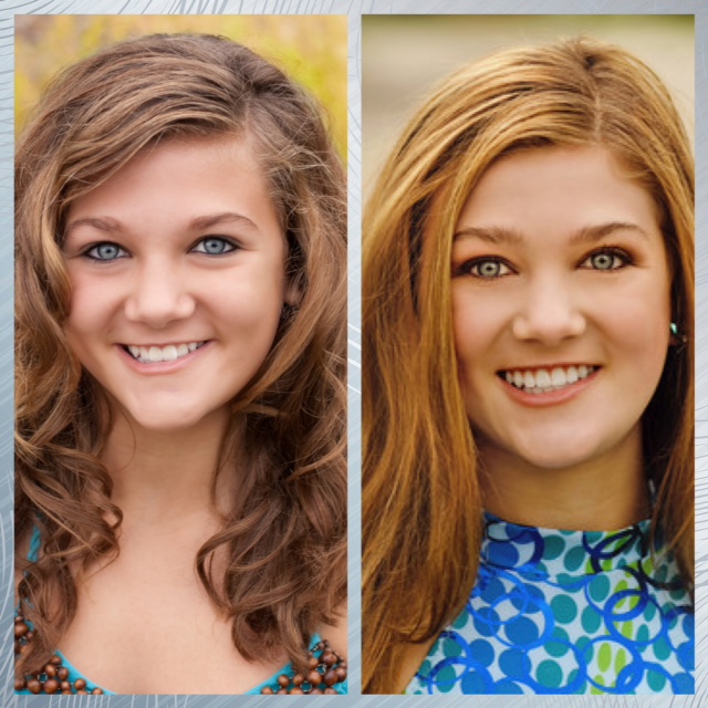 Support For Christi Thomas Before and After Braces Pictures