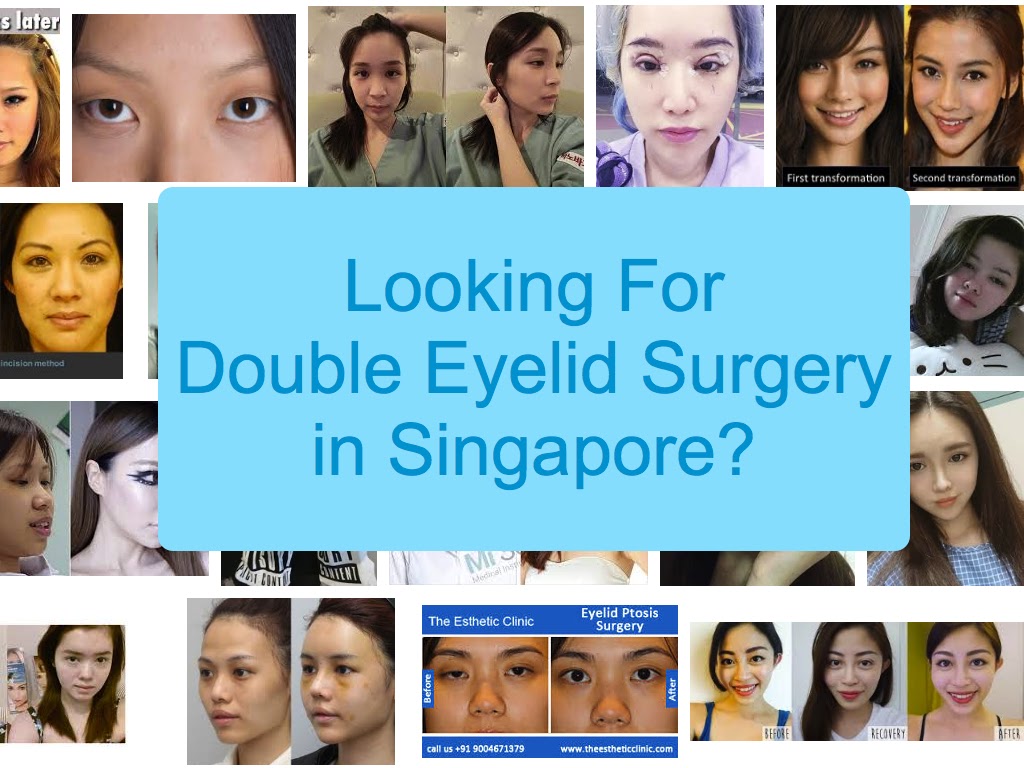 Eye Bag Removal Surgery Singapore Cost and Reviews 2021