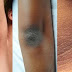 A COMPLETE GUIDE FOR REMOVING DRY AND DARK SKIN ON YOUR NECK, ELBOWS, KNEES AND UNDERARMS