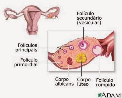 Luteo ovario esquerdo cisto