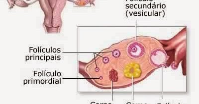 Cisto luteo ovario esquerdo