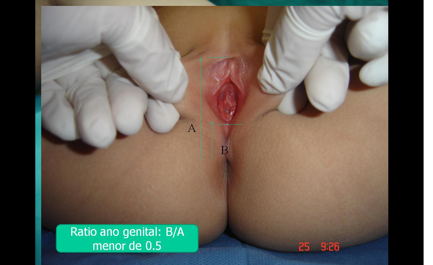 Semiologia pediatrica 4 a los siete aos 2056 видео