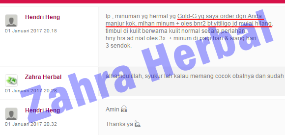Cara Cepat Menghilangkan Vitiligo dengan Ampuh Cara Cepat Menghilangkan Vitiligo dengan Ampuh