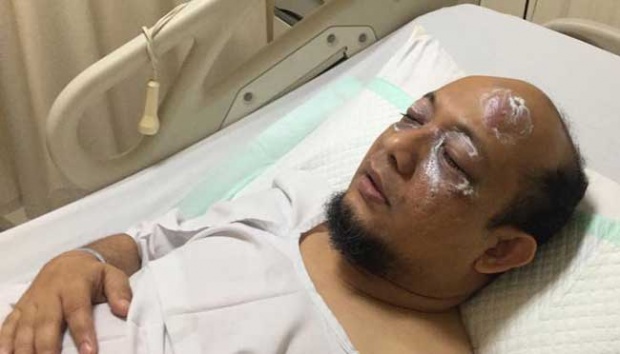 Kasus Novel dan Jazuli, Pengamat Kepolisian: Polisi Terkesan Asal Menjawab