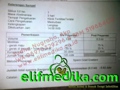 Extreme Oligozoospermia Konsultasi Dan Pengobatan Extreme Oligozoospermia Konsultasi Dan Pengobatan