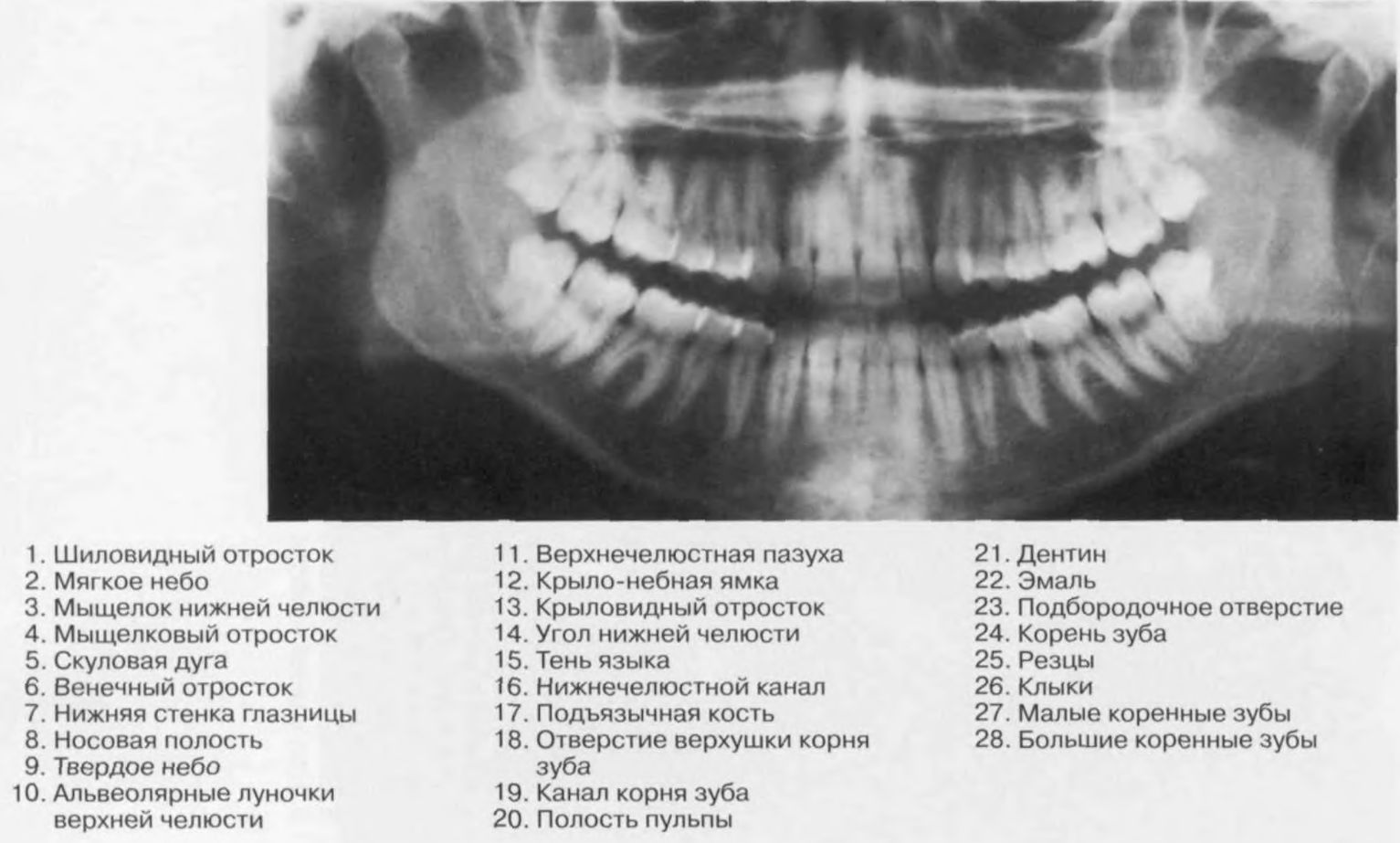 Мыщелок челюсти. Мыщелкового отростка нижней челюсти. Мыщелковый отросток нижней челюсти рентген. Шиловидный отросток нижней челюсти. Венечный отросток нижней челюсти рентген.