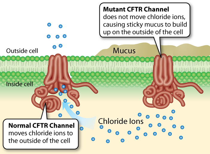Here Be Dragons Examining a Lesser Known Side of Cystic Fibrosis