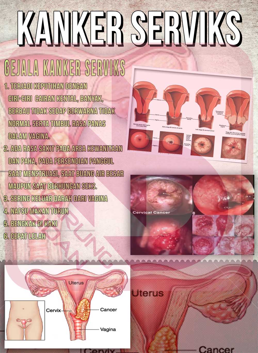 Image Result For Kesehatan Image Result For Kesehatan