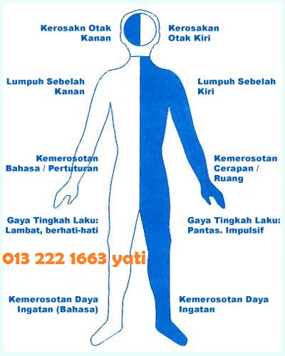 Kesan_strok