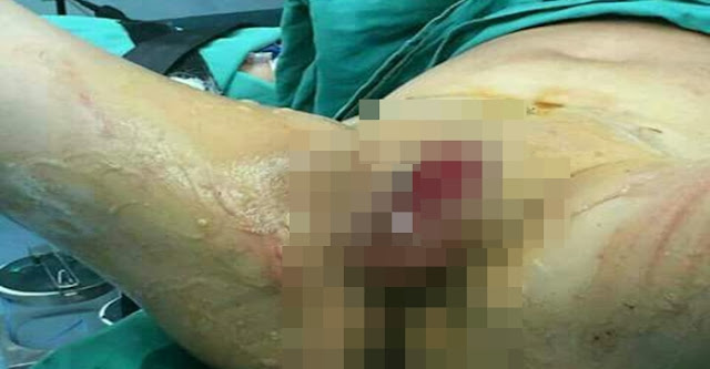 APÓS DESCOBRIR TRAIÇÃO ESPOSA CORTA PÊNIS DO MARIDO