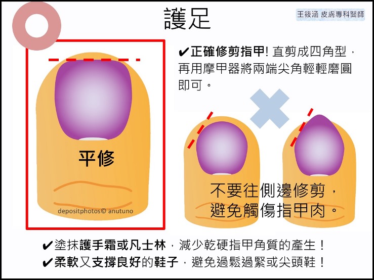 接受化療、標靶治療時,皮膚照護很重要!-預防甲溝炎