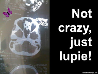 Image: brain scan. Text: Not crazy, just lupie!