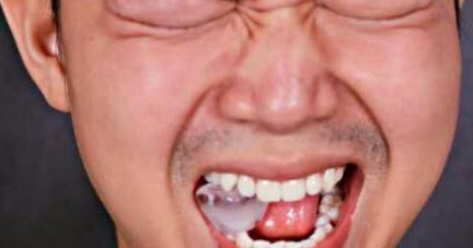 99 Arti Mimpi Gigi Patah Bagian Atas Bawah dalam Islam dan Primbon