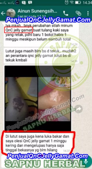 Obat Tradisional Untuk Luka Menganga Obat Tradisional Untuk Luka Menganga
