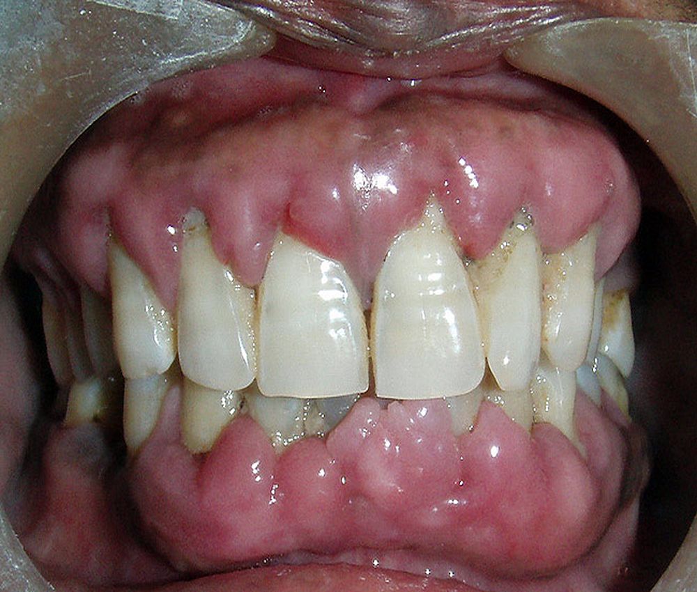 My Image 20