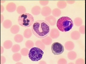 التعداد التفريقي للكريات البيض في الدم White Blood Cell Differential Count