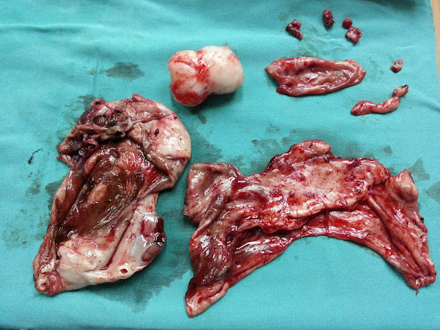 Image result for kandungan rahim rosak