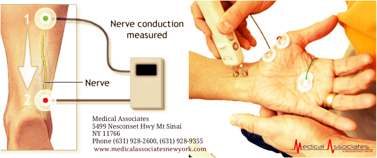 Medical Associates What is the purpose of NVC test and how it is