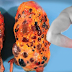 Seriously? Experts Say, These Bad Habits Can Damage Your Kidneys!