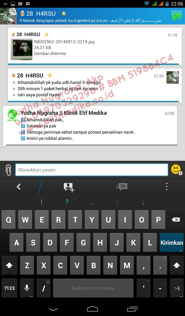 15+ Testimoni Oligozoospermia / Oligospermia  Klinik 