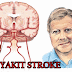 Cara Menghilangkan Penyakit Stroke Cara Menghilangkan Penyakit Stroke