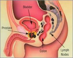natural cure for prostate gland infection natural cure for prostate gland infection