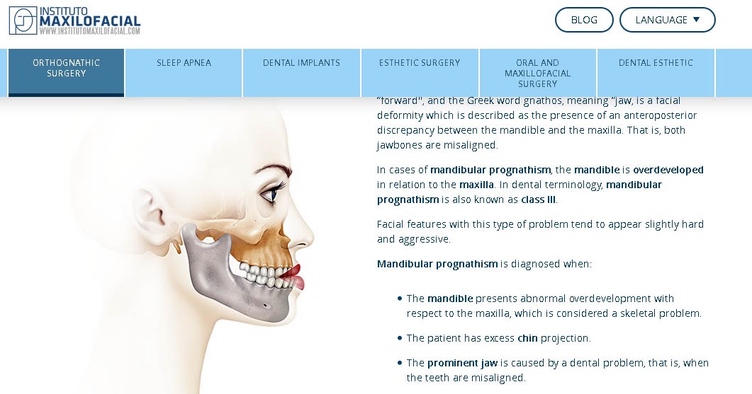 SketchBook. Textile Design, Illustration, Sport mode: Orthognathic