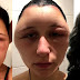 Lumobo Ng Husto Ang Muka Ng Isang Babae sa America Matapos Maglagay ng Hair Dye.