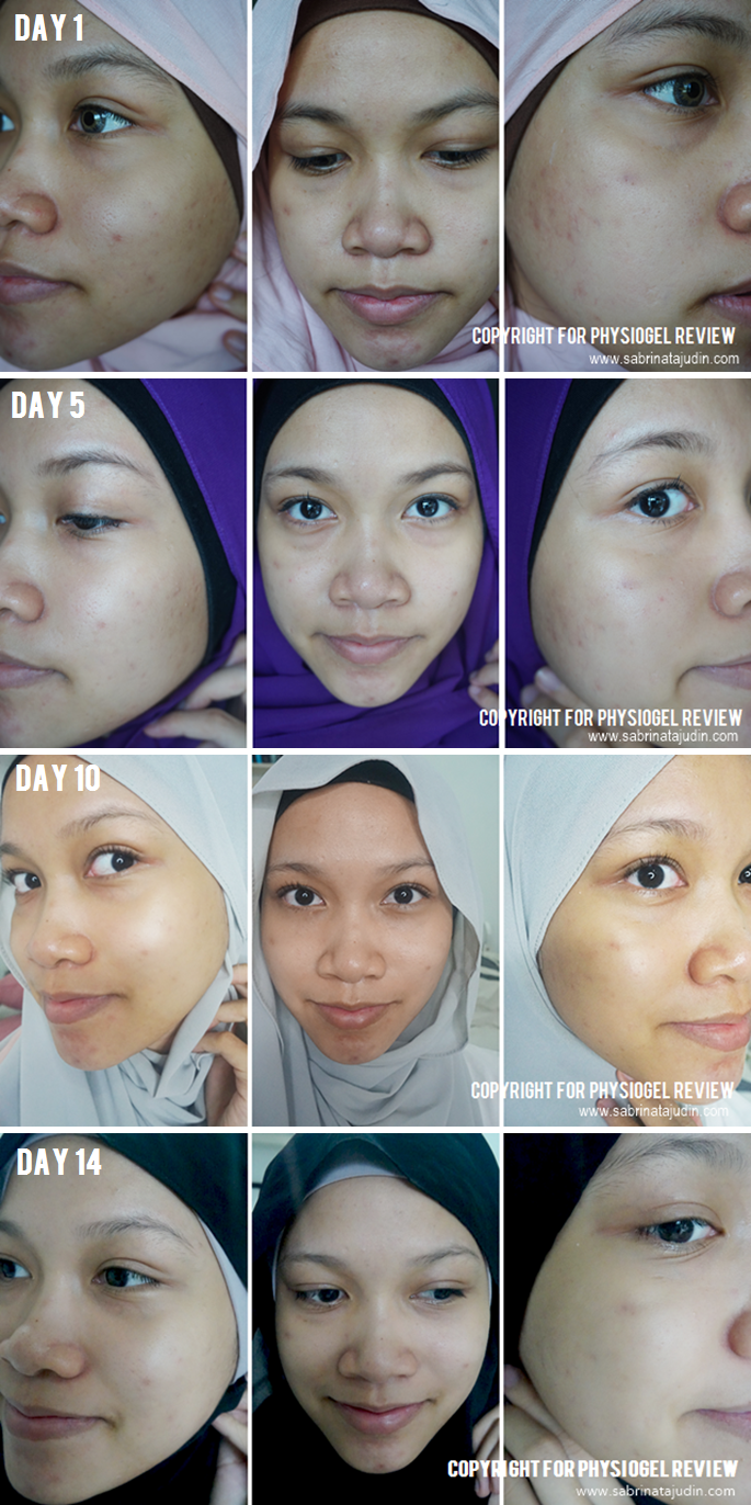 physiogel calming relief cleanser