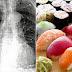 Man’s Body Packed Full of Worms After Eating Sushi