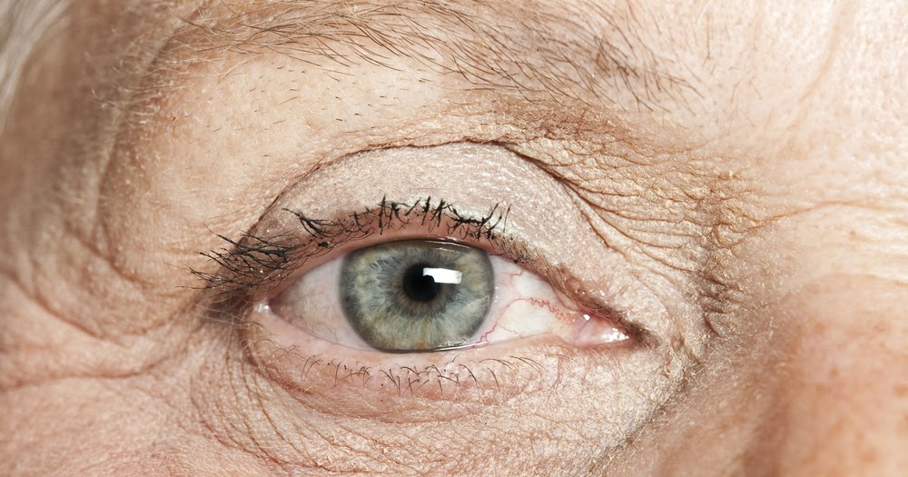 Como Eliminar Las Arrugas de Los Ojos de Forma Natural Como Eliminar Las Arrugas de Los Ojos de Forma Natural