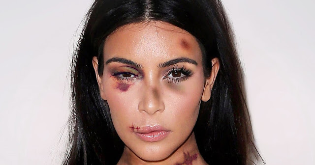 Kim Kardashian Ditodong Lalu Dirampok di Paris, Perhiasan Miliaran Rupiah Melayang