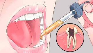 Comment se débarrasser d'un mal de dents