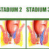 Solusi Baik Obati Wasir Stadium Akhir Tanpa Operasi thumbnail