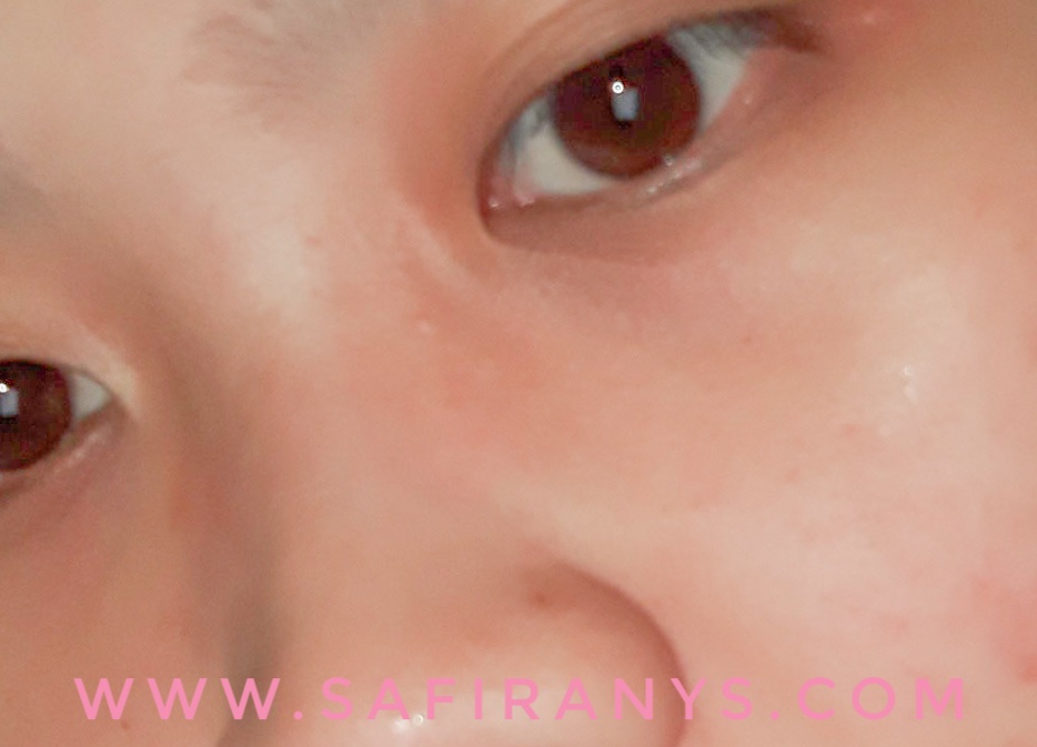 toner untuk clogged pores