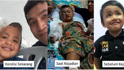 Lagu Pujian Persembahan Alvaro Korban Bom Gereja Samarinda: "Jangan pernah menyerah, jangan berputus asa, mujizat Tuhan ada.."